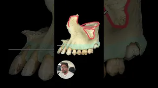 Med School QotD Anatomy of the Maxilla