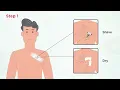 Zywie NanoPatch