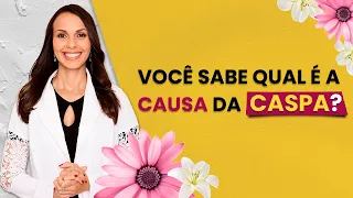 Você sabe qual é a causa da caspa?