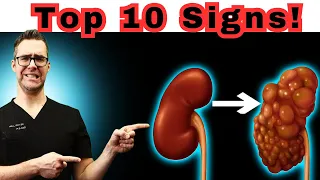 Download Top 10 Signs Your Kidneys are Begging For Help! MP3