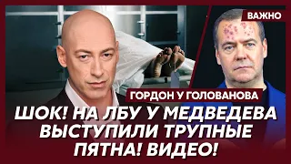 Гордон о страшной болезни Путина