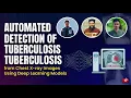 Automated Detection of Tuberculosis from Chest X-ray Images Using Deep Learning Models PUC