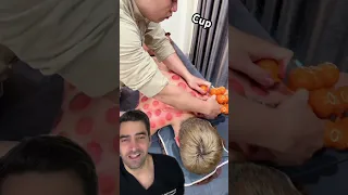 Cupping
