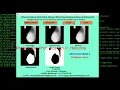 Breast Cancer Detection Using CNN Convolutional Neural Network Python OpenCV Project