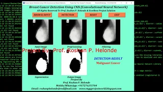 Breast Cancer Detection Using CNN Convolutional Neural Network Python OpenCV Project