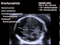 Download Lagu Fetal Biometery