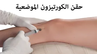 حقن الكورتيزون الموضعية  حقن الكورتيزون الموضعية