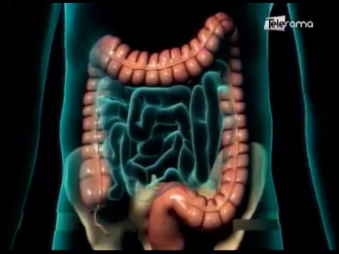 Harry el hibrido sufre complicaciones en su salud por Apendicitis