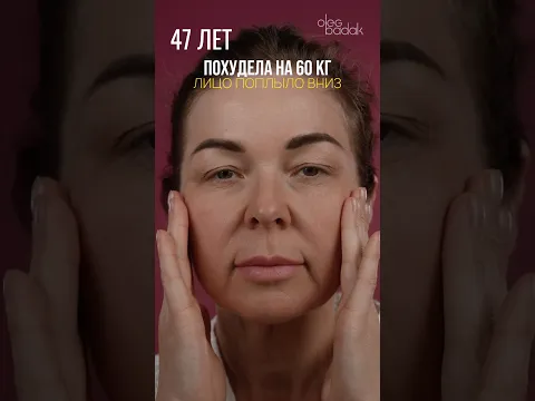 60 кг позади. Но почему в зеркале отражается не та, кого я ожидала? Доктор БАДАК О.Е.