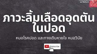 โรคลิ่มเลือดอุดตันในปอดคืออะไร และเกิดขึ้นได้อย่างไร