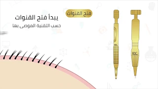 مراحل زراعة الشعر دندنها