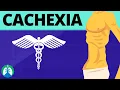 Cachexia Medical Definition Quick Explainer