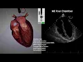 Transesophageal Echocardiography TEE Imaging