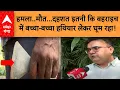 Download Lagu Bahraich Bhediya News: हमला..मौत...दहशत इतनी कि बहराइच में बच्चा-बच्चा हथियार लेकर घूम रहा!