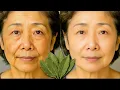 Download Lagu Beter dan Botox! Bay Leaf wist rimpels als een gum - zelfs na 70