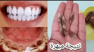 بمكون واحد بترميه تبيض الاسنان في 3 دقائق وازاله الاصفرار فقط مجررربه مني شخصيآاااا