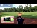 The SCOUTEE Smart Radar Gun - Baseball