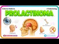 Download Lagu 2. Prolactinoma | Internal Medicine Endocrinology