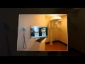 Dental Implants Smithtown NY - Michael Kampourakis DDS