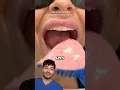 How to Make A Dental Mouth Guard