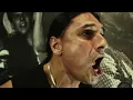 IGNITE - Still Wide Awake & Guilty Wounds (Official Music Videos)