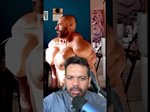 Men with Implants