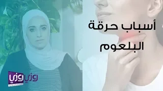 أسباب حرقة البلعوم وعلاجه 