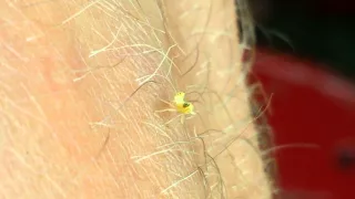 This little dancing bug