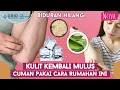 Download Lagu Cara Alami Menghilangkan Biduran di Tubuh, Bisa Dilakukan Cuman di Rumah Aja! MP3