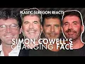 Simon Cowell Plastic Surgery Addicted to Botox Filler