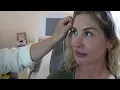 Je ogen liften zonder operatie? Wel met hifu #ultraformer