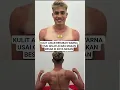 Download Lagu KONDISI KULIT AISAR MEMERAH USAI GELAR ACARA MAKAN BESAR DI MEDAN PANASNYA TERIK MATAHARI MEDAN