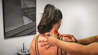 MASSAGEM RELAXANTE PARA TRAPÉZIO, ESCÁPULA E CERVICAL