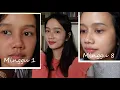 Download Lagu Caraku memperbaiki kulitku dari iritasi, beruntusan, bengkak.