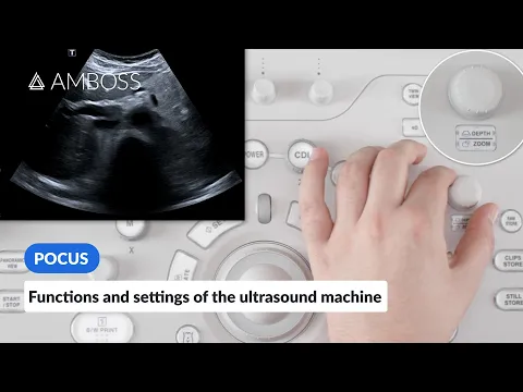 Download MP3 Point of Care Ultrasound - Functions and Settings of the Ultrasound Machine - AMBOSS Video