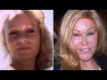 Catwoman Plastic Surgery Disaster Story