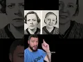 People Before And After Lobotomies Part 1