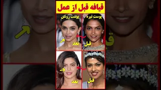 Shorts قیافه بازیگران هندی قبل از جراحی پلاستیک و عمل زیبایی  Shorts قیافه بازیگران هندی قبل از جراحی پلاستیک و عمل زیبایی