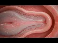 Download Lagu Anatomy of Virginity – Myths, Facts, and the Hymen