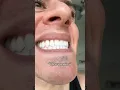 Download Lagu Anyways my dentist love me 😬 #teeth #trend #creator #trending #viral