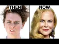 Nicole Kidman s NEW FACE Plastic Surgery Analysis