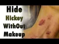 How To Hide A Hickey How to remove love bite in 24 hours