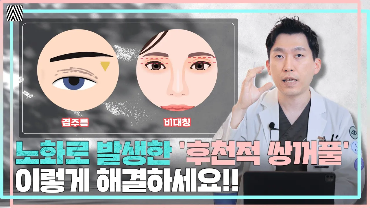 노화로 생기는 '후천적 쌍꺼풀' 자가 테스트법부터 해결 방법까지!! 후천적 쌍꺼풀 2편_[4월31일 성형외과]
