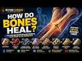 How Do Broken Bones Heal Amazing 3D Animation