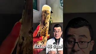 اقوى شامبو طبيعي اعمليه بنفسك دندنها