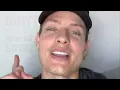 Matt Rife kommer til Danmark 15 10 24 Royal Arena