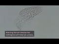 Download Lagu Single-celled Organism Dies