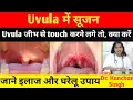 What to do if the uvula is the tongue
