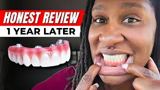 Are My Dental Implants Still Worth It After 1 Year My Pros Cons