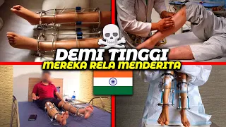 Mereka Sengaja Mematahkan Kaki Sendiri… Demi Ini